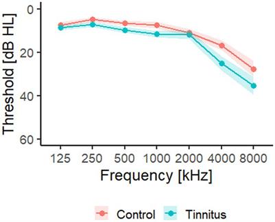 Effect of sound therapy on whole scalp oscillatory brain activity and distress in chronic tinnitus patients